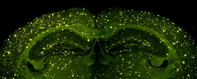 A mouse with Alzheimer's disease.