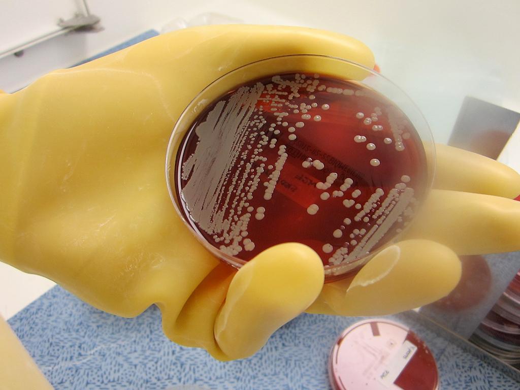 Y.pestis and S. aureus mixed culture.